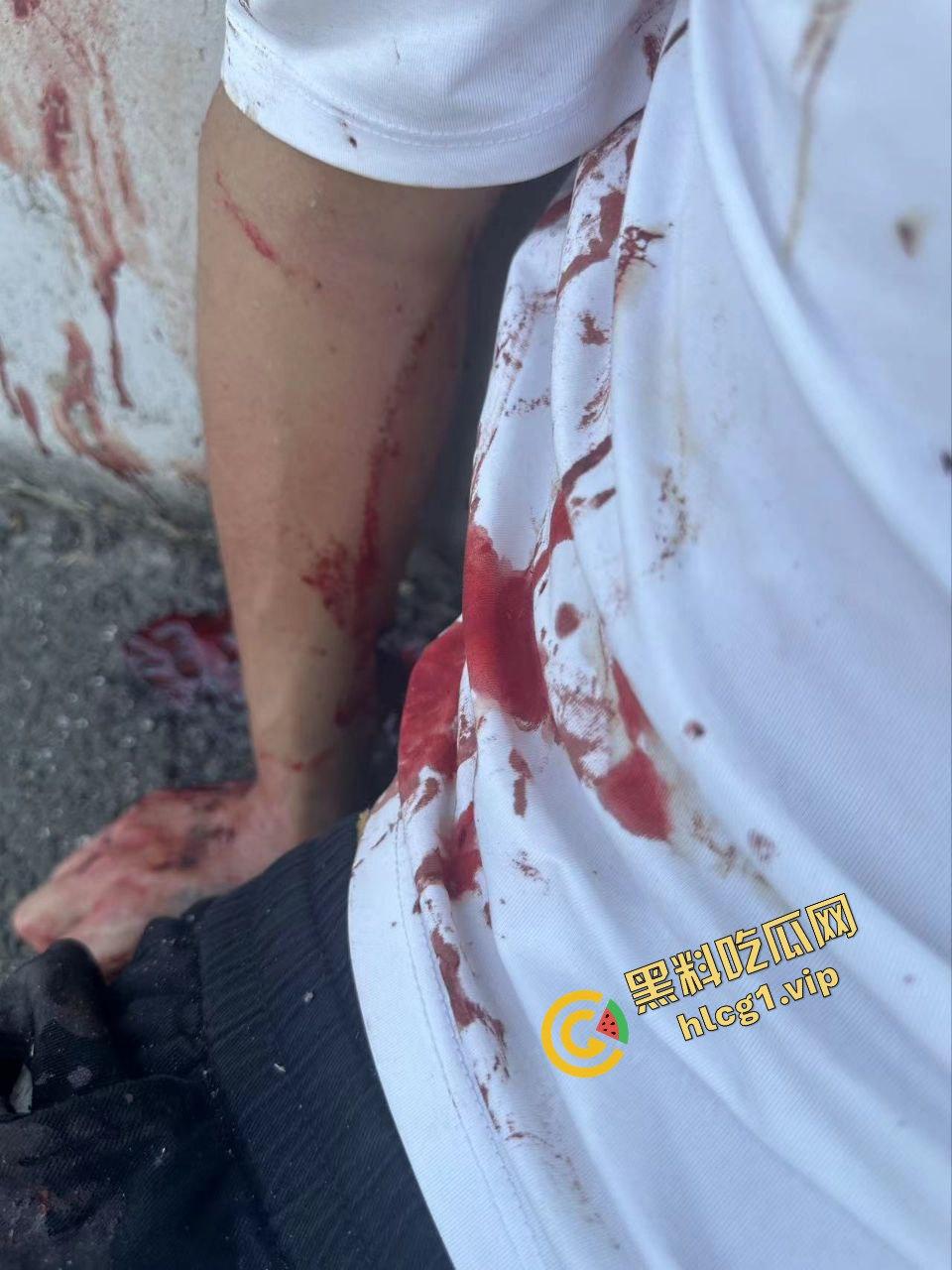 长安汽车高速车祸！严重车祸 血迹斑斑 然而气囊未弹 引人愤怒！-5