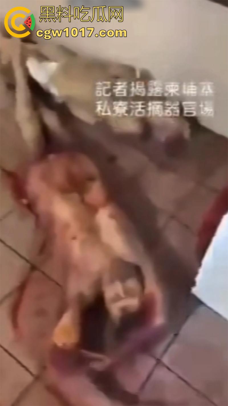 柬埔寨器官交易场实拍，猪仔狗推的最终贩卖地，难怪这里每个人都值钱，只要血型匹配有买主，立刻就会被拉走！-8